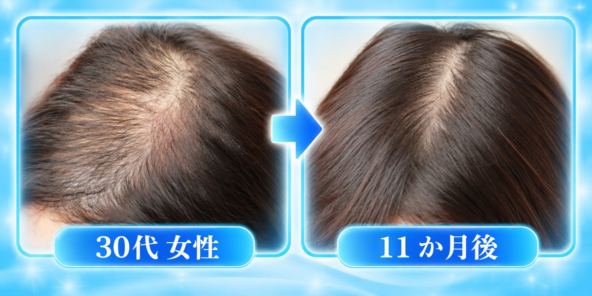 30代女性 施術前と11か月後